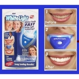 Домашнее отбеливание зубов White Light (Вайт Лайт)